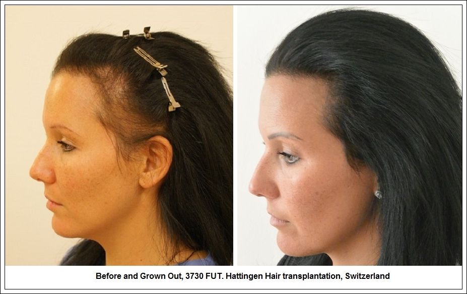 Maschera gelatinosa per capelli con vitamine B